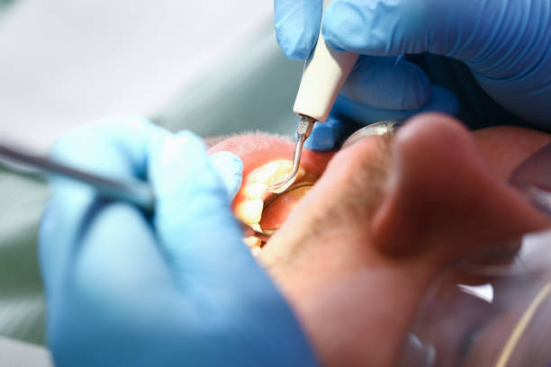 Best Weekend Emergency Dentist in Louisa, VA