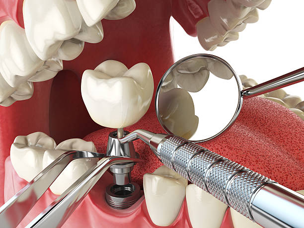Best Emergency Dental Surgery in Louisa, VA
